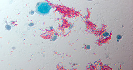 Erreger der Tuberkulose (Mycobacterium tuberculosis)