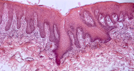 Zunge eines Menschen, Querschnitt