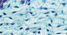 Lockeres Bindegewebe