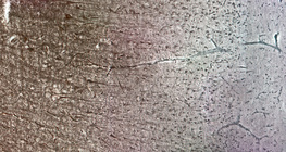 Cortex cérébral humain avec les différentes couches de cellules