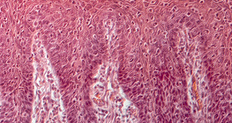 Zunge eines Menschen, Querschnitt