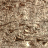 Menselijke hersenschors met grote piramidecellen