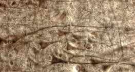 Cortex cérébral humain avec des cellules pyramidales géantes