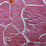 Doorsnede van een schildklier