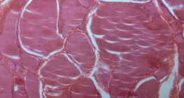 Schilddrüse, Gewebeschnitt