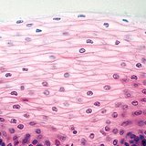 Plaveiselcelepitheel (zonder keratinocyten)