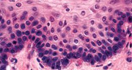 Mehrschichtiges, nicht verhornendes Plattenepithel