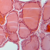 Doorsnede van een schildklier