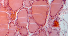 Schilddrüse, Gewebeschnitt