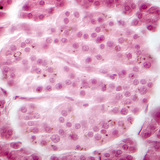 Alvleesklier (fasecontrastafbeelding) - de eilandjes van Langerhans cellen zijn minder helder