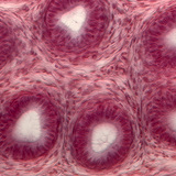 Dwarsdoorsnede van zaadbuisjes