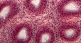 Vue en coupe de tubes séminifères