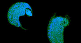 Larve de guêpe Ichneumon se développant comme parasite dans une poupe de drosophile