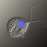 De oorzakelijke agens van trichomonas vaginalis (Differentieel interferentie contrast afbeelding, de celkern is blauw gekleurd)