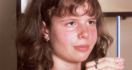 Untersuchung der Akkommodation des Auges