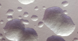 E. coli Bakterienkolonien (ungefärbt, weiß)