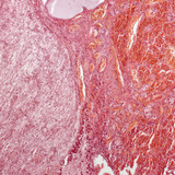 Hypofyse (lengtedoorsnede, lage vergroting)