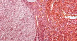 Glande pituitaire (vue en coupe longitudinale, faible grossissement)