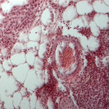 Doorsnede van een menselijke long