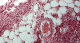 Lunge eines Menschen, Gewebeschnitt