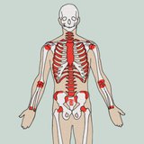 Ophopingen van bloedcellen