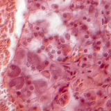 Dwarsdoorsnede van een hypofyse