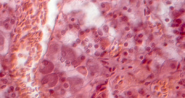 Vue en coupe d'une glande pituitaire