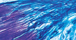 Verbindung zwischen Muskel und Sehne