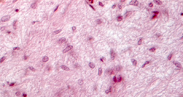 Vue en coupe d'une glande pituitaire