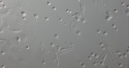 Blutzellen einer Drosophila Larve