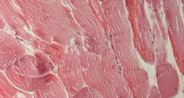 Tendon (vue en coupe)