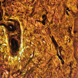 Dwarsdoorsnede van mensenhuid (vingers)