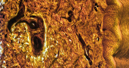 Haut eines menschlichen Fingers, Querschnitt