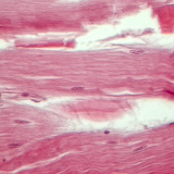 Tendon (vue en coupe longitudinale)