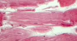 Tendon (vue en coupe longitudinale)