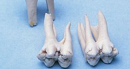 Höckriger Backenzähne