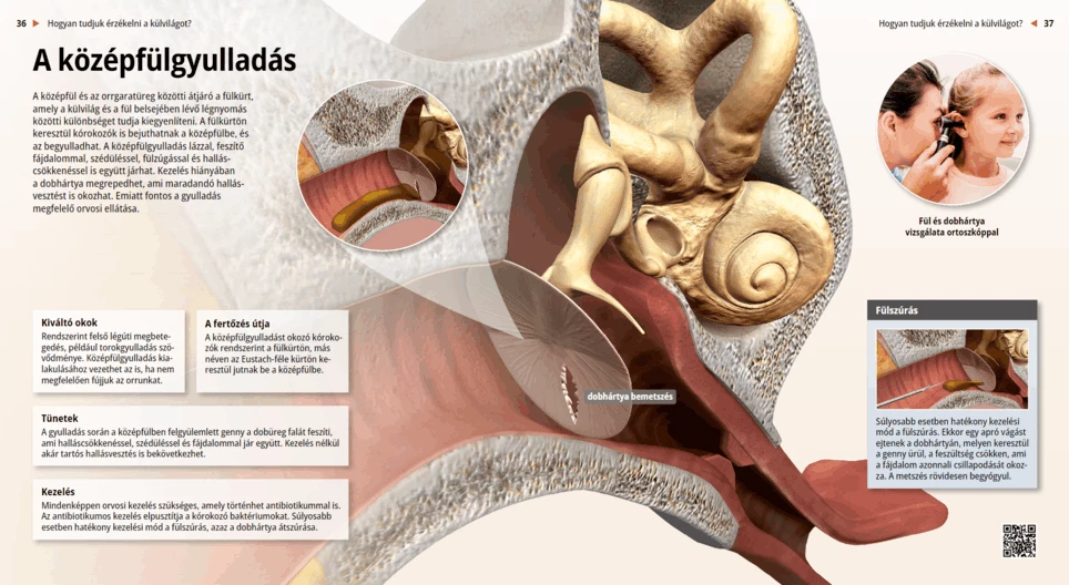 Middle Ear Infection, Otitis Media