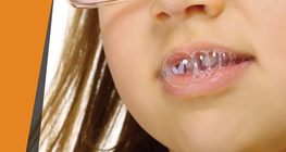 Salive «&nbsp;corrosive »