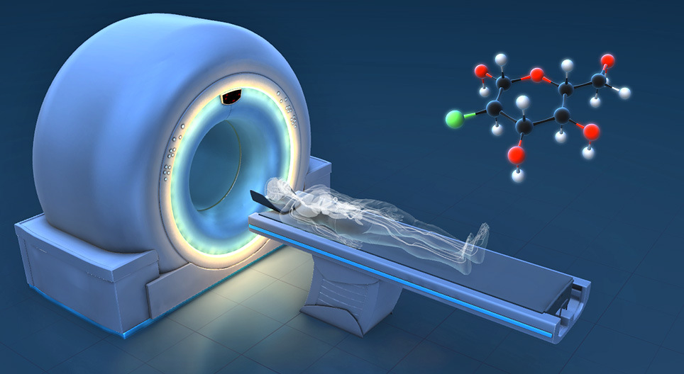 Hoe werkt PET-CT?