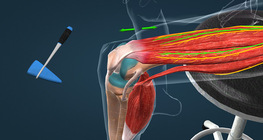 Patellar reflex